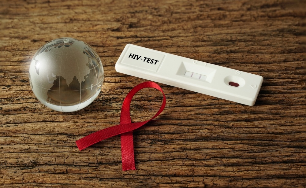 HIV: Ελπιδοφόρο φάρμακο επιβραδύνει την εξέλιξη της νόσου