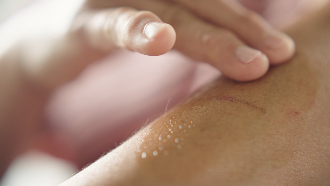 Επιστήμονες-ανακαλύπτουν-πρωτεΐνη-που-θεραπεύει-επίμονες-πληγές