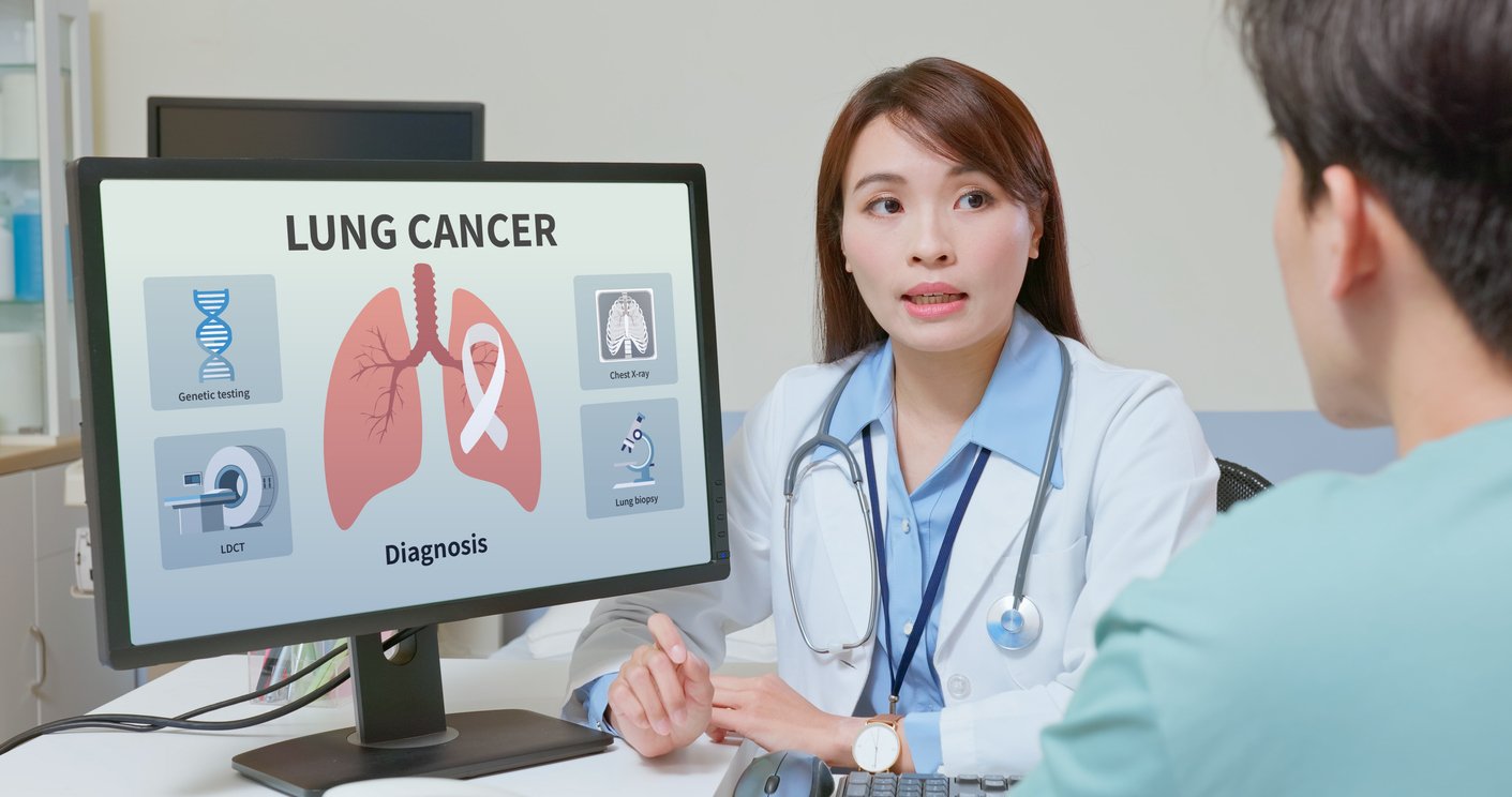 Καρκίνος-του-πνεύμονα-στις-γυναίκες:-Σταθεροποιούνται-τα-ποσοστά-θνησιμότητας-στην-Ευρώπη