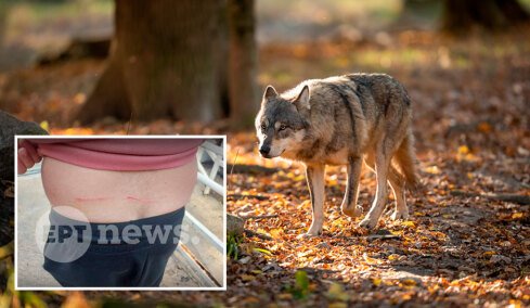 «Μου έσκισε τη μπλούζα και μου έκανε γρατζουνιές»: Πώς σώθηκε ο άνδρας που δέχθηκε επίθεση από λύκο στο Τατόι