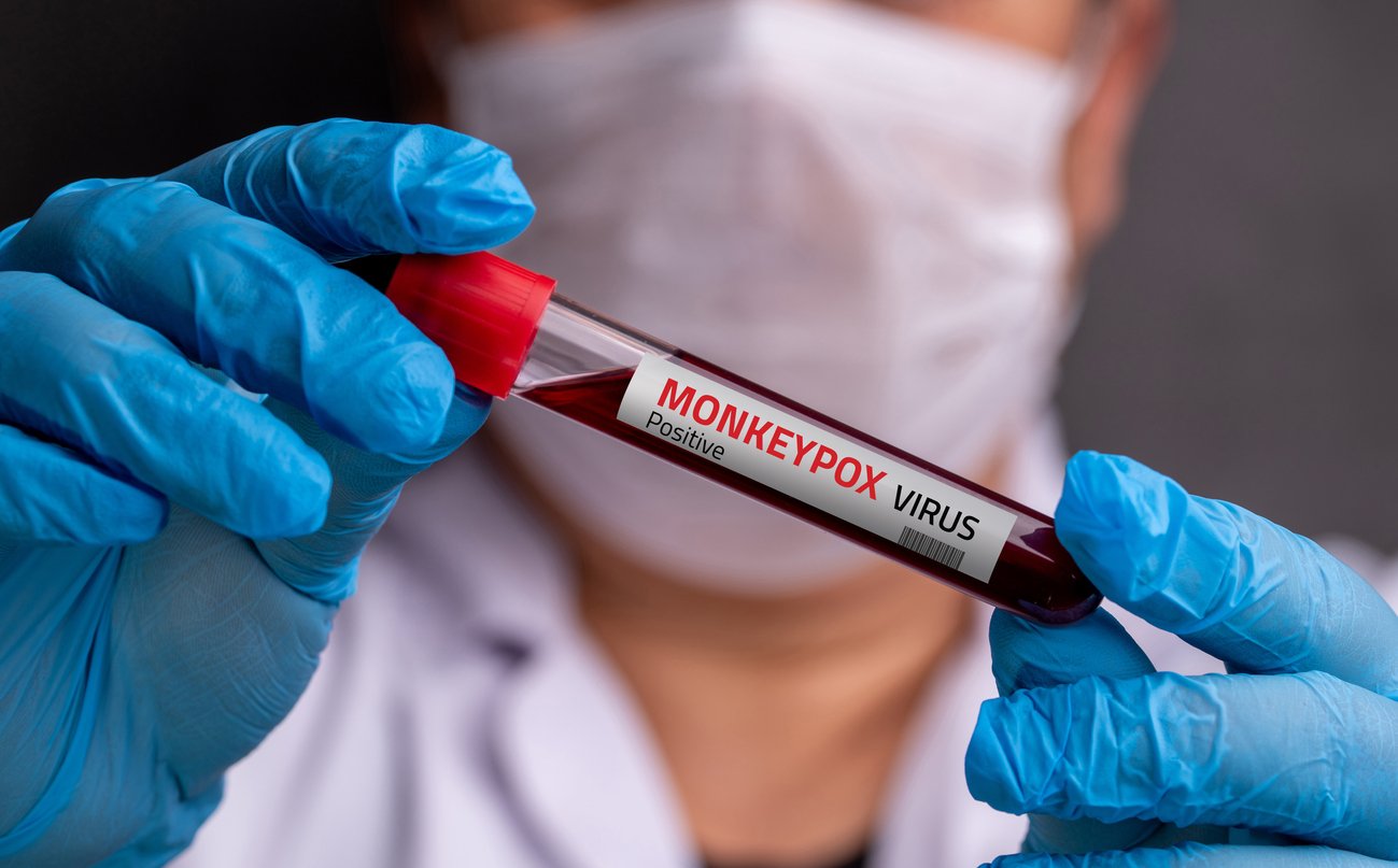 Ευλογιά-των-πιθήκων:-Δεκάδες-κρούσματα-από-το-επικίνδυνο-στέλεχος-clade-1b-στο-Βερολίνο