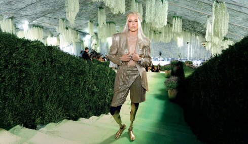 Η ιστορία του μοντέλου Lauren Wasser: Το τοξικό σοκ από ταμπόν, ο ακρωτηριασμός και η καριέρα στη μόδα