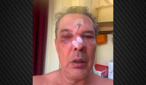 Απίστευτο περιστατικό στο Χαϊδάρι: Ξυλοκόπησε άγρια άνδρα μέσα σε ιατρείο όταν του έκανε παρατήρηση να μιλά πιο σιγά στο κινητό