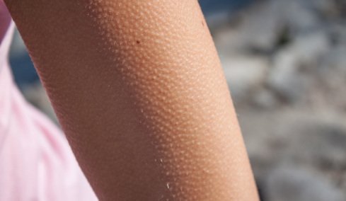 Γιατί ανατριχιάζουμε ξαφνικά χωρίς να κρυώνουμε; Η απίθανη εξήγηση του σώματός μας  
